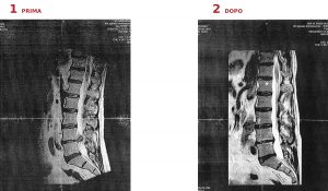 fisio-line-ozonoterapia-diapositive